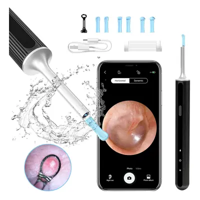 SUNUO X8 Smart Visual Ear Cleaner, Acne Squeezing, 5MP HD Camera, 6-Axis Gyroscope, Silicone Ear